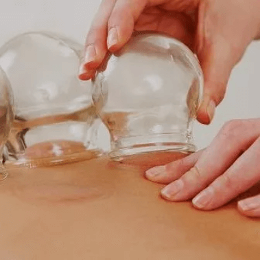 Cupping Technique | LeReve Spinal Care